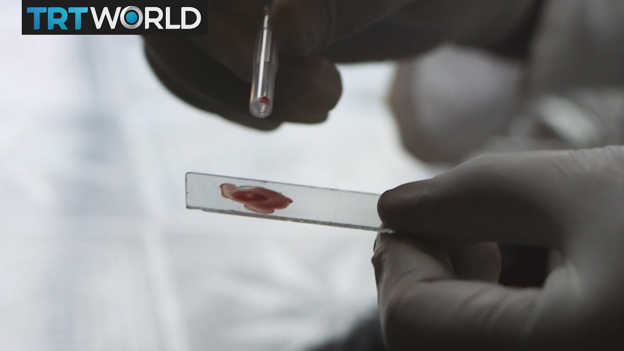 Money Talks: Uganda's Matibabu app diagnoses malaria