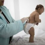 zika birth defects felipe dana ap - Pragas e Eventos