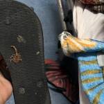 Escorpião foi morto e ficou grudado na sola de calçado no HGV (Foto: Redes sociais/Reprodução)