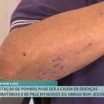 idosos pombos - Pragas e Eventos