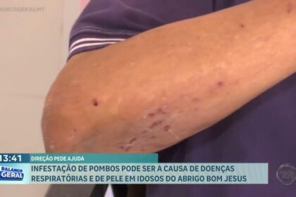 idosos pombos - Pragas e Eventos