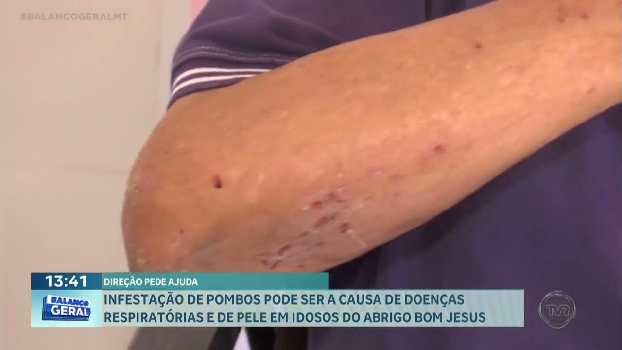 idosos pombos - Pragas e Eventos