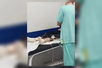 menino de 9 anos e picado por escorpiao ao calcar tenis - Pragas e Eventos