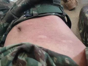 Percevejos em Alojamentos Militares de Cascavel: Alerta