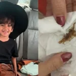Menino de 3 anos na UTI após picada de escorpião em escola alerta para o perigo letal do vetor