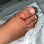 duas criancas sao picadas por escorpiao em menos de uma semana em creche - Pragas e Eventos