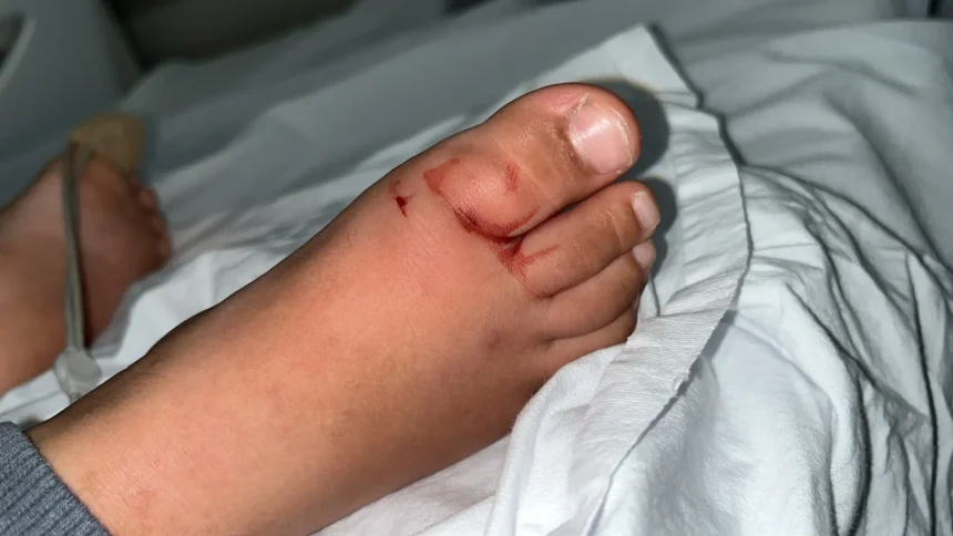 duas criancas sao picadas por escorpiao em menos de uma semana em creche - Pragas e Eventos